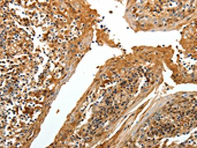 TNR Antibody