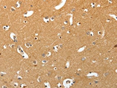 TNR Antibody