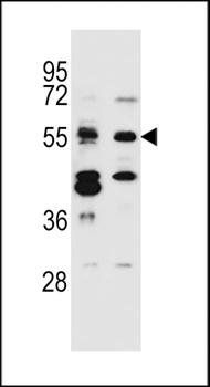 TNRC4 antibody
