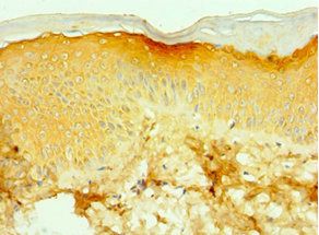 TNXB Antibody