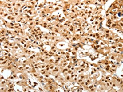 TNXB Antibody