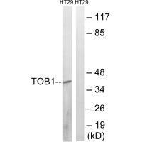 TOB1 (Ab-164) antibody