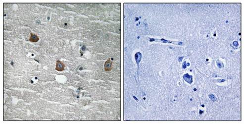 TOB1 (Phospho-Ser164) Antibody