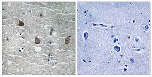 TOB1 (phospho-Ser164) antibody