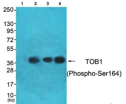 TOB1 (phospho-Ser164) antibody