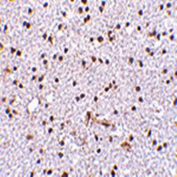 TOCA-1 Rabbit Polyclonal Antibody
