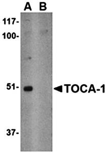 TOCA-1 Rabbit Polyclonal Antibody