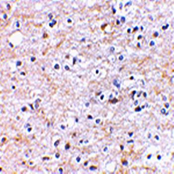 TOCA-1 Rabbit Polyclonal Antibody