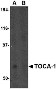 TOCA-1 Rabbit Polyclonal Antibody