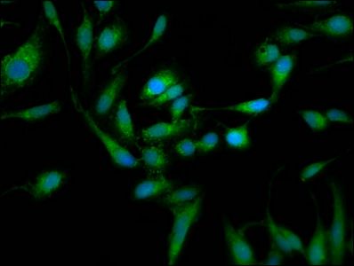TOM1L1 Antibody