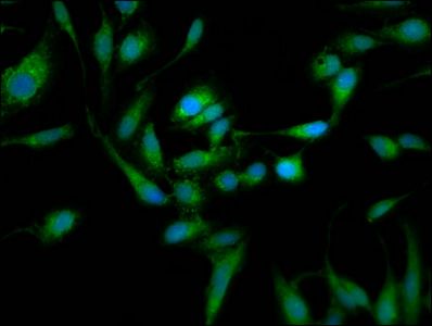 TOM1L1 antibody