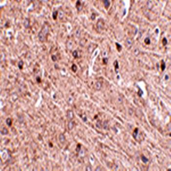 TOM70 Antibody