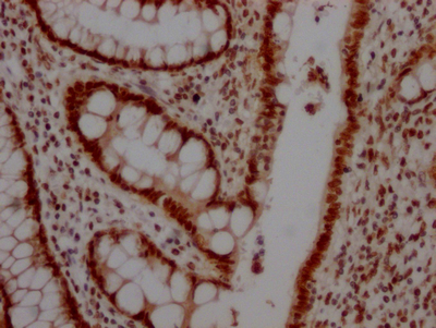 TOP1 Recombinant Monoclonal Antibody