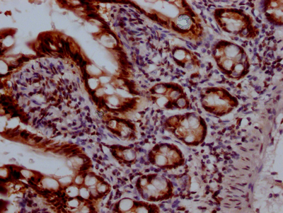 TOP1 Recombinant Monoclonal Antibody