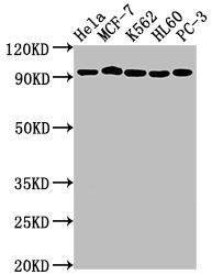 TOP1 Recombinant Monoclonal Antibody