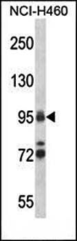 TOP1 antibody
