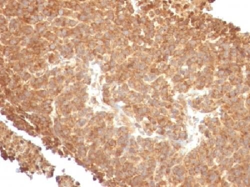 Topoisomerase I, Mitochondrial (TOP1MT) Antibody