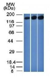 TOP2A antibody