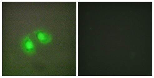 TOP2A Antibody