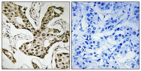 TOP2A Antibody