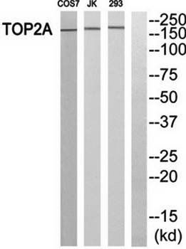 TOP2A Antibody