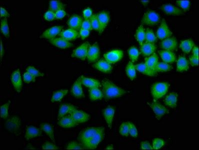 TOP2B Antibody