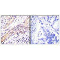 TOP2B Antibody