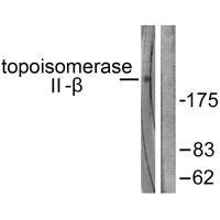 TOP2B Antibody