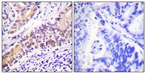 TOP2B antibody