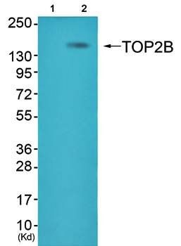TOP2B antibody