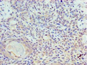 TOPBP1 Antibody