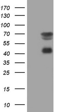 Topoisomerase II alpha Antibody