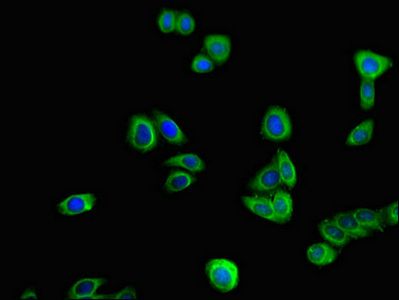 TOR1A antibody