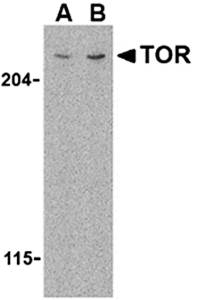 TOR Antibody