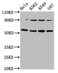 TOX antibody