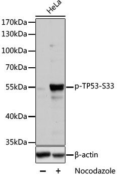 TP53 (Phospho-S33) antibody