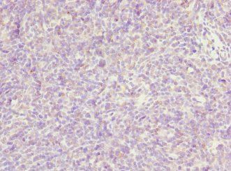 TP53AIP1 antibody