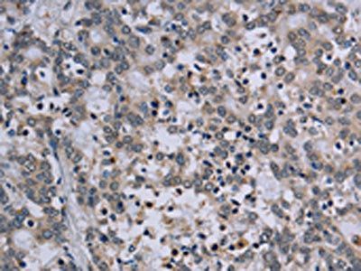 TP53AIP1 antibody