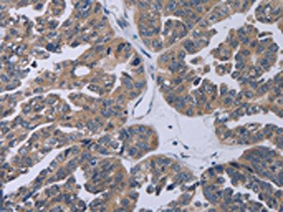 TP53AIP1 Antibody