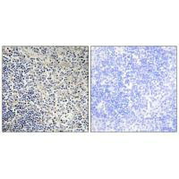 TP53AIP1 Antibody