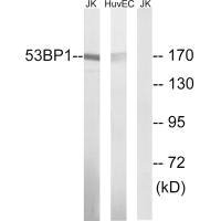 TP53BP1 (Ab-29) antibody