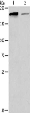 TP53BP2 antibody