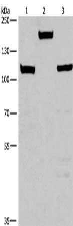 TP53BP2 Antibody