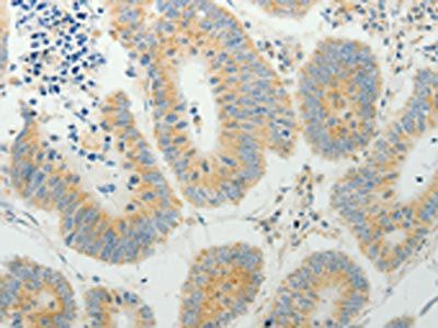 TP53BP2 Antibody