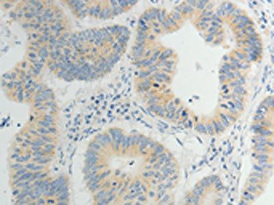 TP53BP2 Antibody