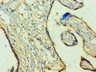 TP53I3 Antibody