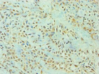 TP53I3 Antibody
