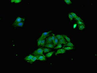 TP53INP1 Antibody