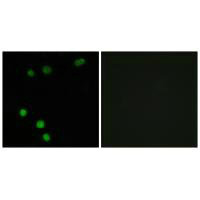 TP53INP2 Antibody