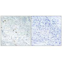 TP53INP2 antibody